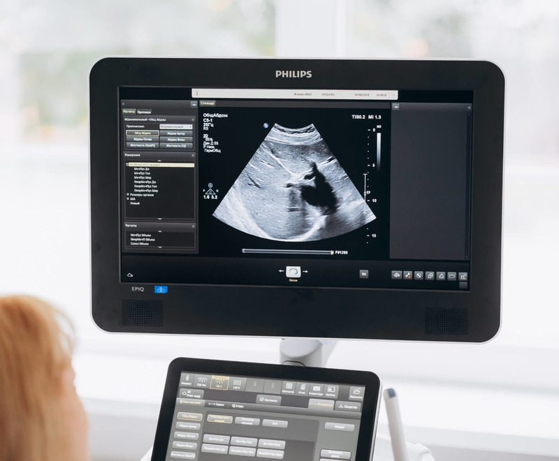 Гинекомастия